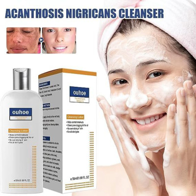 Cleansing & Whitening Lotion For Acne & Spots